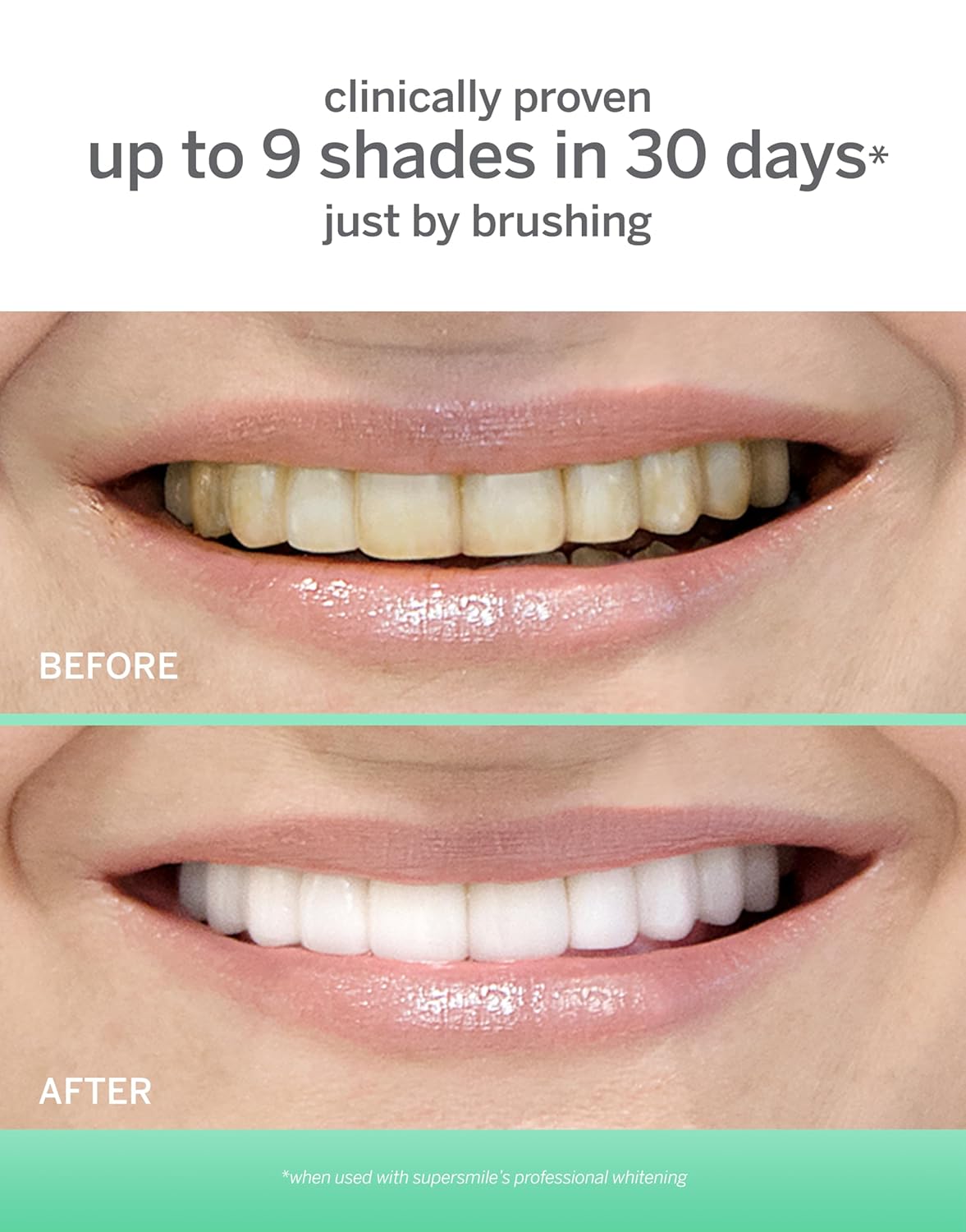 Supersmile Extra Whitening Luxury Set (6-month Supply)
