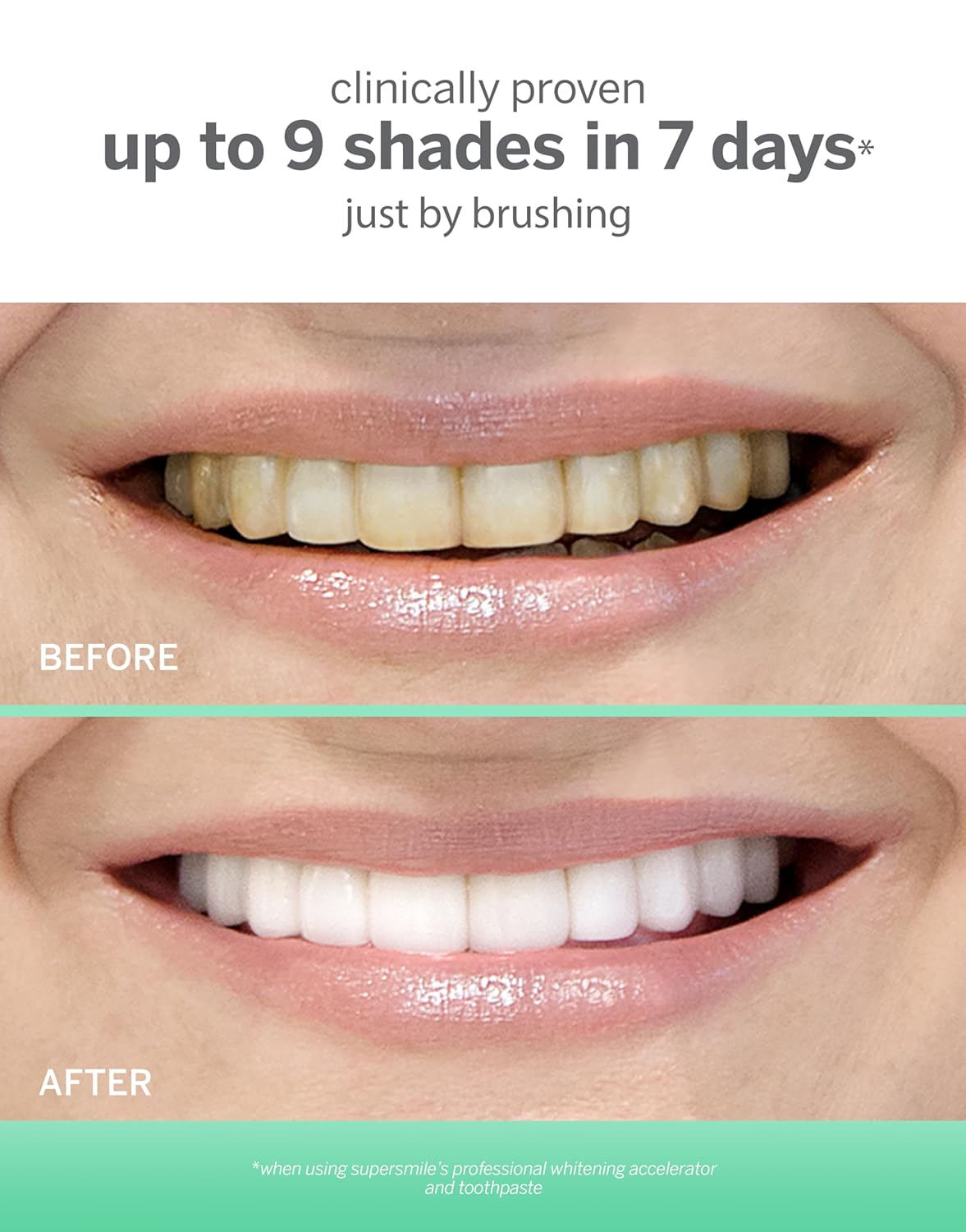 Supersmile Extra Whitening System (2-month Supply)