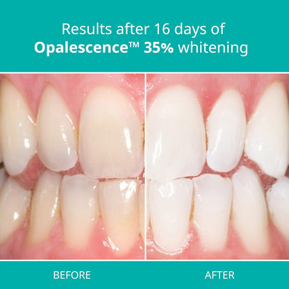 Opalescence PF Whitening Gel 8 Syringes