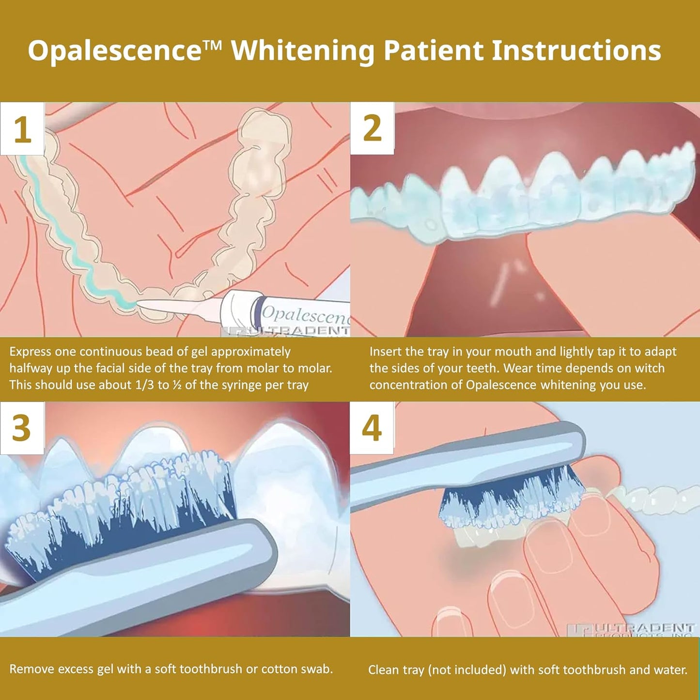 Opalescence Quick PF 45% Whitening Gel 4 Syringes